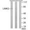 LIM Domain Kinase 2 antibody, A03511, Boster Biological Technology, Western Blot image 