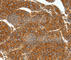 Somatostatin Receptor 1 antibody, A3134, ABclonal Technology, Immunohistochemistry paraffin image 