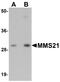 NSE2 (MMS21) Homolog, SMC5-SMC6 Complex SUMO Ligase antibody, A06693, Boster Biological Technology, Western Blot image 
