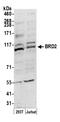 Bromodomain Containing 2 antibody, 13020, QED Bioscience, Western Blot image 