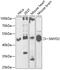 Histone methyltransferase SMYD2 antibody, GTX54717, GeneTex, Western Blot image 