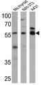 Thyroid Hormone Receptor Alpha antibody, GTX82858, GeneTex, Western Blot image 