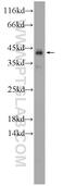 Uncharacterized protein KIAA0087 antibody, 24973-1-AP, Proteintech Group, Western Blot image 