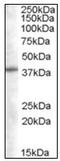Sorting Nexin 16 antibody, AP23839PU-N, Origene, Western Blot image 