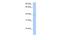 Zinc Finger Protein 385D antibody, PA5-69713, Invitrogen Antibodies, Western Blot image 