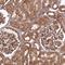 Coatomer Protein Complex Subunit Gamma 1 antibody, NBP2-55178, Novus Biologicals, Immunohistochemistry paraffin image 
