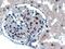 UBE2I antibody, GTX41193, GeneTex, Immunohistochemistry paraffin image 