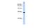 Trinucleotide Repeat Containing Adaptor 6A antibody, A04293-1, Boster Biological Technology, Western Blot image 