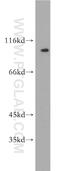 Serpin Family B Member 10 antibody, 21719-1-AP, Proteintech Group, Western Blot image 