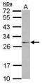 Eukaryotic Translation Initiation Factor 4H antibody, GTX121223, GeneTex, Western Blot image 