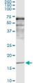 Synuclein Alpha antibody, H00006622-M01, Novus Biologicals, Immunoprecipitation image 