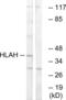 Putative HLA class I histocompatibility antigen, alpha chain H antibody, abx014526, Abbexa, Western Blot image 