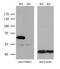 Checkpoint Kinase 2 antibody, M00277-1, Boster Biological Technology, Western Blot image 