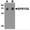Tripartite Motif-Containing 51 antibody, MBS150465, MyBioSource, Western Blot image 