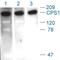 Carbamoyl-Phosphate Synthase 1 antibody, ab3682, Abcam, Western Blot image 
