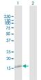 Nanos C2HC-Type Zinc Finger 2 antibody, H00339345-B01P, Novus Biologicals, Western Blot image 