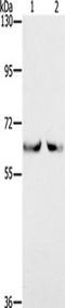 Kelch Like Family Member 2 antibody, TA350120, Origene, Western Blot image 