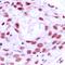 Minichromosome Maintenance Complex Component 4 antibody, orb214236, Biorbyt, Immunohistochemistry paraffin image 