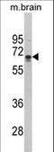 Zinc Finger MYND-Type Containing 11 antibody, LS-B13755, Lifespan Biosciences, Western Blot image 