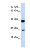 SL cytokine antibody, NBP1-62304, Novus Biologicals, Western Blot image 
