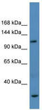 Adaptor Related Protein Complex 3 Subunit Beta 1 antibody, TA334212, Origene, Western Blot image 