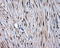 MCL1 Apoptosis Regulator, BCL2 Family Member antibody, LS-C115034, Lifespan Biosciences, Immunohistochemistry paraffin image 