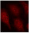 Cyclin Dependent Kinase 6 antibody, LS-C335940, Lifespan Biosciences, Immunofluorescence image 
