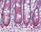 Stromelysin-3 antibody, orb88013, Biorbyt, Immunohistochemistry paraffin image 
