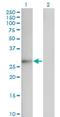 Fibroblast Growth Factor 12 antibody, H00002257-M10, Novus Biologicals, Western Blot image 