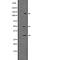 Caspase 2 antibody, abx148935, Abbexa, Western Blot image 