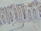 Galectin 3 antibody, GTX34030, GeneTex, Immunohistochemistry paraffin image 