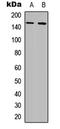 Colony Stimulating Factor 1 Receptor antibody, LS-C358954, Lifespan Biosciences, Western Blot image 