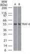 TNF Receptor Associated Factor 6 antibody, PA1-41008, Invitrogen Antibodies, Western Blot image 