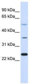 Zinc Finger Protein 488 antibody, TA341503, Origene, Western Blot image 