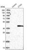 Cathepsin K antibody, PA5-51673, Invitrogen Antibodies, Western Blot image 