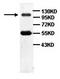 Piwi Like RNA-Mediated Gene Silencing 2 antibody, orb77215, Biorbyt, Western Blot image 
