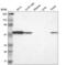 Tryptophan--tRNA ligase 1 antibody, NBP2-55159, Novus Biologicals, Western Blot image 