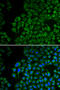 Tyrosinase antibody, 14-493, ProSci, Immunofluorescence image 