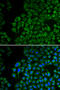 Tyrosinase antibody, 14-493, ProSci, Immunofluorescence image 