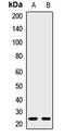 Syndecan-2 antibody, orb412030, Biorbyt, Western Blot image 