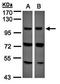 VPS11 Core Subunit Of CORVET And HOPS Complexes antibody, orb69972, Biorbyt, Western Blot image 