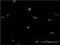 LIM Homeobox 2 antibody, H00009355-M02, Novus Biologicals, Immunocytochemistry image 