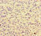 Heterogeneous Nuclear Ribonucleoprotein F antibody, LS-C678239, Lifespan Biosciences, Immunohistochemistry paraffin image 
