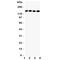 Insulin Receptor Substrate 1 antibody, R31393, NSJ Bioreagents, Western Blot image 
