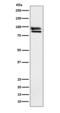 OS9 Endoplasmic Reticulum Lectin antibody, M04158-1, Boster Biological Technology, Western Blot image 
