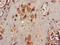 Potassium Two Pore Domain Channel Subfamily K Member 1 antibody, LS-C675041, Lifespan Biosciences, Immunohistochemistry paraffin image 