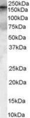 Rho Guanine Nucleotide Exchange Factor 5 antibody, MBS420902, MyBioSource, Western Blot image 