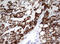 Ornithine Carbamoyltransferase antibody, M00721, Boster Biological Technology, Immunohistochemistry paraffin image 