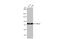 Acyl-CoA Synthetase Long Chain Family Member 4 antibody, GTX635616, GeneTex, Western Blot image 