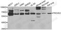 Ro60, Y RNA Binding Protein antibody, A6986, ABclonal Technology, Western Blot image 